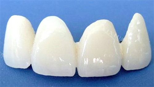 阿曼吉尔巴赫义齿多少钱一颗？系列、地区差异影响价格，真相在这里！(图1)