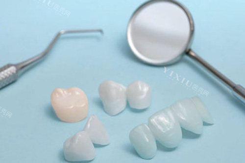 阿曼吉尔巴赫义齿多少钱一颗？系列、地区差异影响价格，真相在这里！(图2)