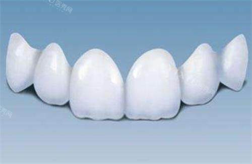 阿曼吉尔巴赫义齿多少钱一颗？系列、地区差异影响价格，真相在这里！(图5)
