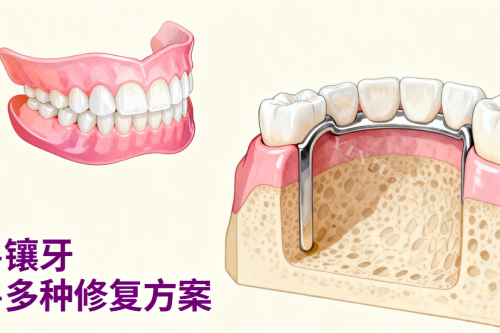 天津镶半口牙价格全解析：活动假牙、吸附性义齿与种植覆盖义齿的性价比选择(图1)
