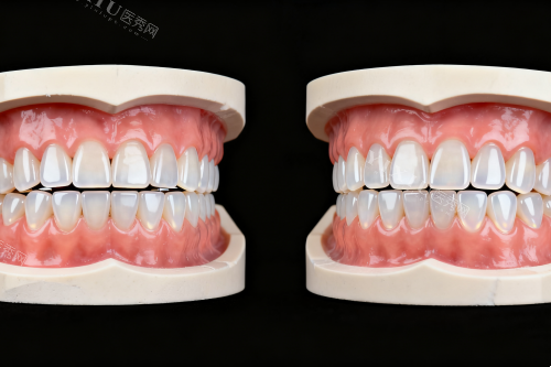 高端种植牙选择指南：上海优仕美地口腔就诊全记录，细节控必看！(图5)