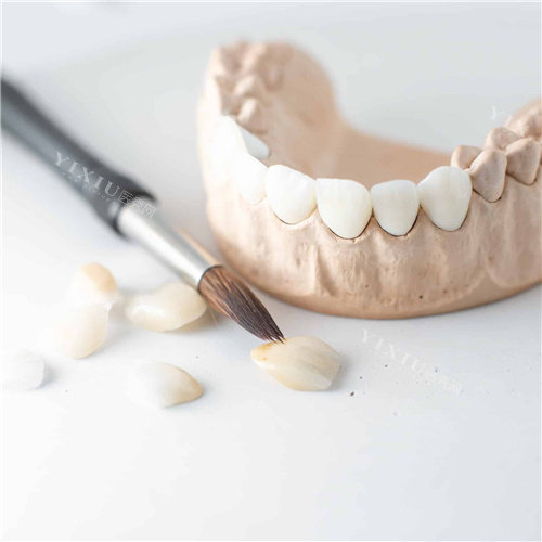 钟浩然医生牙齿贴面定制服务介绍，不同材质贴面价格对比，打造自然美观笑容！(图8)