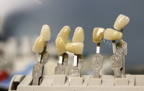 钟浩然医生牙齿贴面定制服务介绍，不同材质贴面价格对比，打造自然美观笑容！(图2)