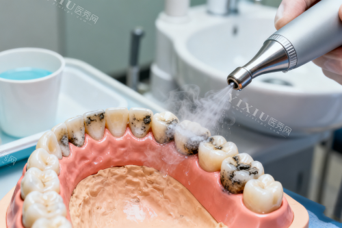 武汉市中心医院口腔科安全吗？看牙流程和收费情况，地址怎么坐车！(图10)