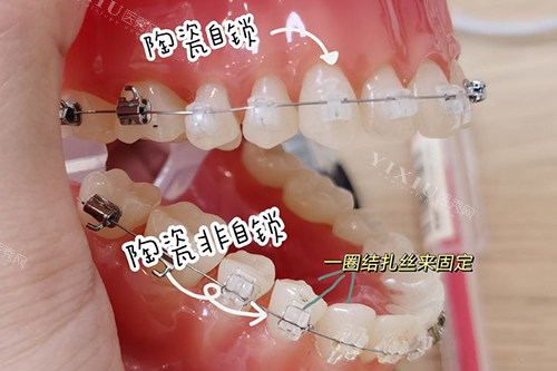 河北医科大学第三医院口腔科口碑咋样？医生技术和营业时间，附详细位置指引！(图3)
