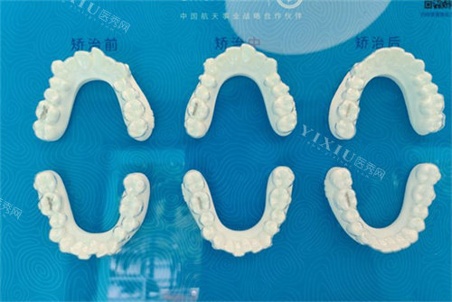 河北医科大学第三医院口腔科口碑咋样？医生技术和营业时间，附详细位置指引！(图1)