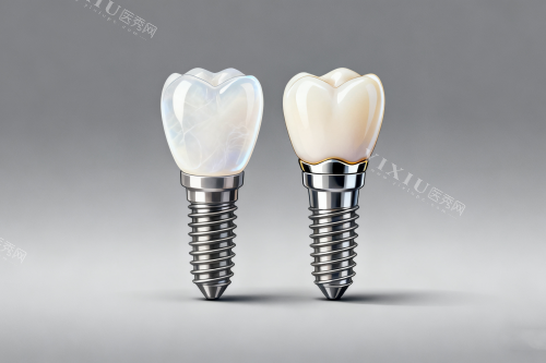 钛特利种植体国产身份实锤！特有盘点：本土研发团队+专有表面处理技术，为何能比肩进口品牌？(图2)