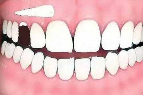 钦州正规的口腔医院有哪些？网选10大牙科榜单,美澳／粤桂等种植牙正畸超放心(图5)