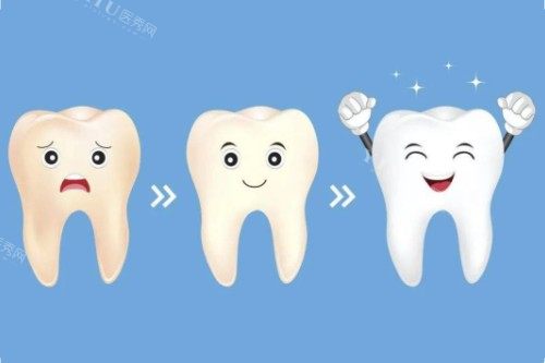 河北保定定兴致康口腔看牙价格一览：瓷贴面2690元起，种植牙3180元起！(图5)