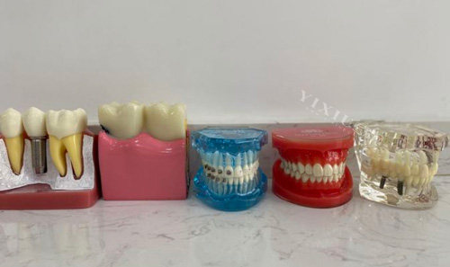 河北保定定兴致康口腔看牙价格一览：瓷贴面2690元起，种植牙3180元起！(图2)