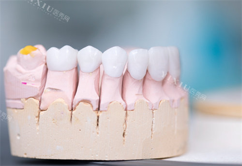 河北保定定兴致康口腔看牙价格一览：瓷贴面2690元起，种植牙3180元起！(图8)