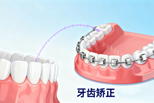 宝藏！平顶山湛河艾特口腔，多样诊疗项目开启口腔健康新体验！(图6)