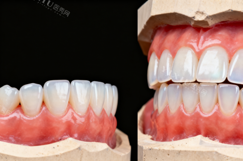 菏泽定陶心悦口腔价格表，2026种植牙2980元起、隐形矫正19800元起、根管治疗300元起~(图7)