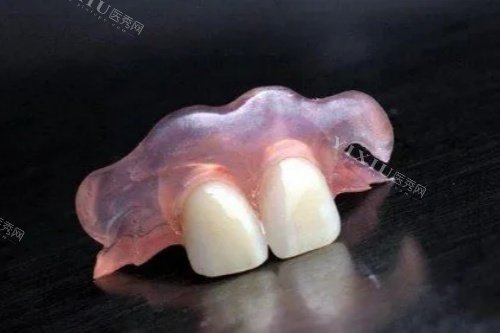 活动义齿卡通图