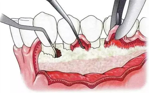 深圳铭德口腔楼梯
