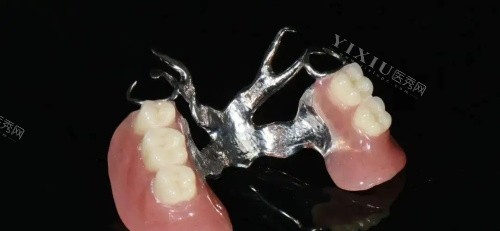 活动义齿维他灵支架示意图