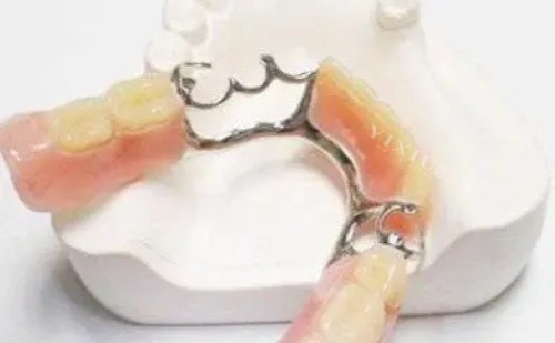 维他灵支架制作完成图