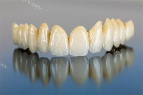 假牙模型细节图片