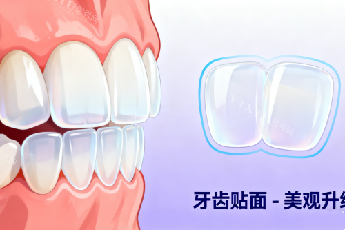 牙齿贴面美白牙齿卡通图