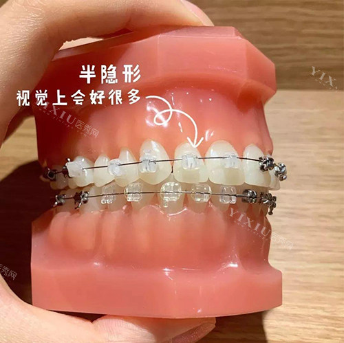 安卓健种植牙表面工艺