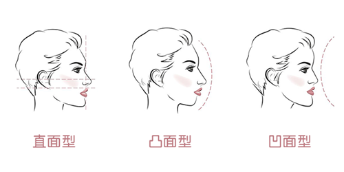 牙齿矫正面型问题.png