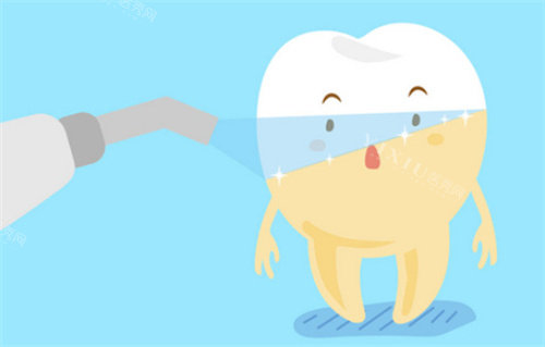 牙齿美白前后对比