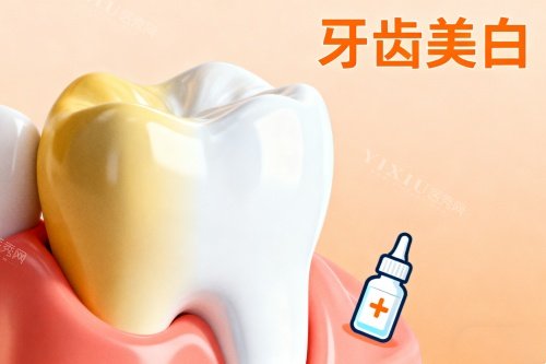 牙齿美白卡通图片展示