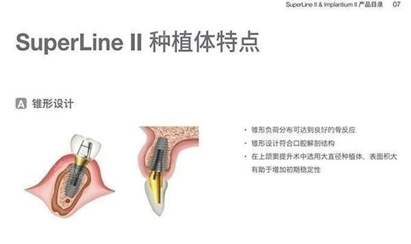 登腾二代种植体特色图片.jpg